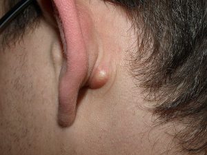 boule derrière l'oreille boule derrière l'oreille