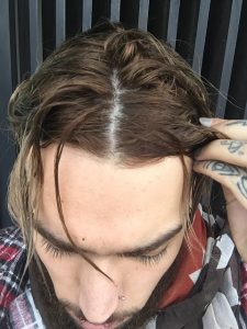avis forcapil hair activ avis forcapil hair activ