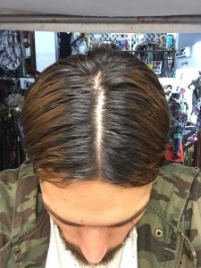 avis forcapil hair activ forcapil hair activ
