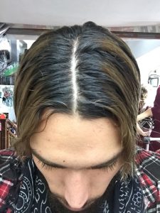 forcapil hair activ forcapil hair activ