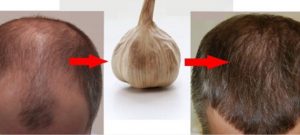 huile d'ail cheveux avant après huile d'ail cheveux avant après