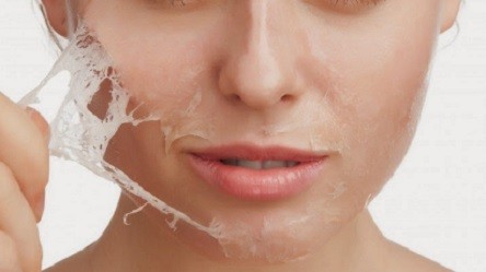 peau qui pèle