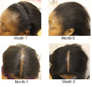 test et avis sur l'huile de ricin pour les cheveux test et avis sur l'huile de ricin pour les cheveux