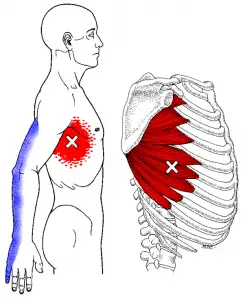 douleur des côtes douleur des côtes