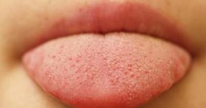 gout de sang dans la bouche au réveil gout de sang dans la bouche au réveil